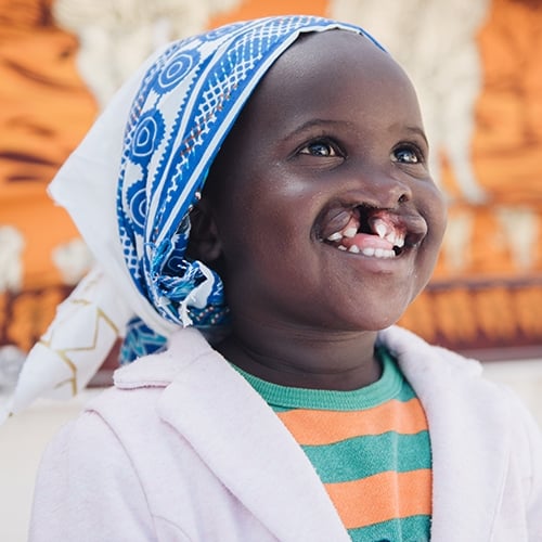 Sponsor Cleft Lip or Cleft Palate Surgery